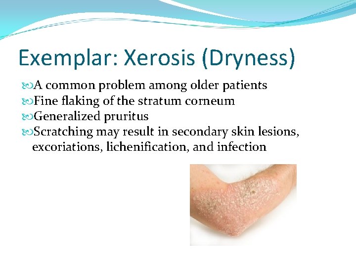 Exemplar: Xerosis (Dryness) A common problem among older patients Fine flaking of the stratum