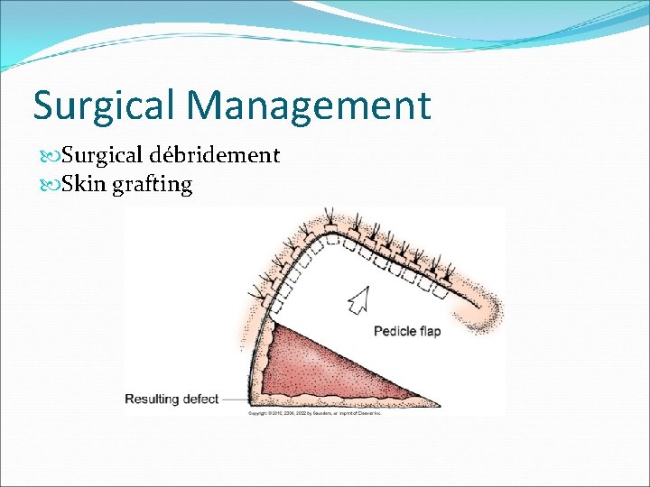 Surgical Management Surgical débridement Skin grafting 