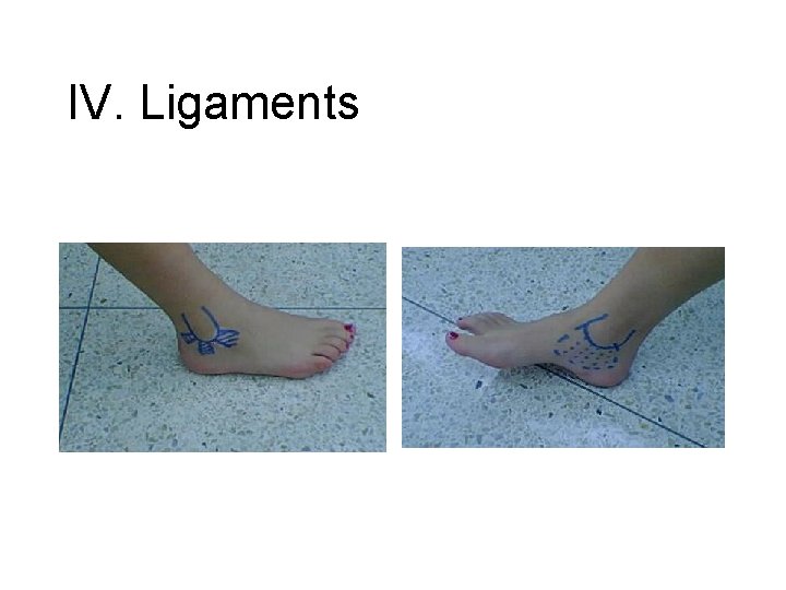IV. Ligaments 