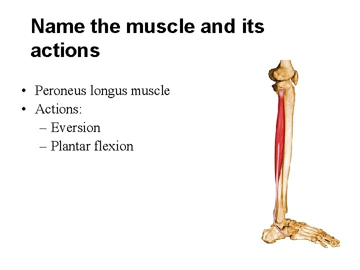 Name the muscle and its actions • Peroneus longus muscle • Actions: – Eversion