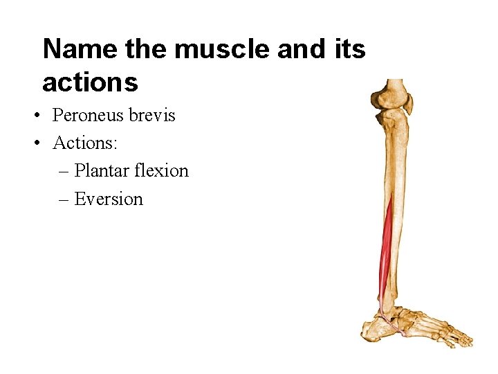 Name the muscle and its actions • Peroneus brevis • Actions: – Plantar flexion