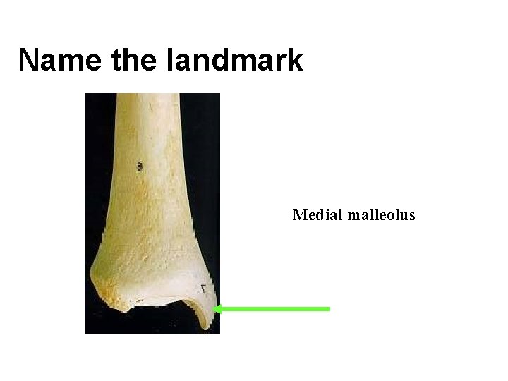 Name the landmark Medial malleolus 