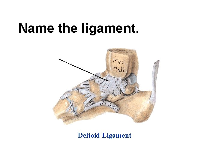 Name the ligament. Deltoid Ligament 