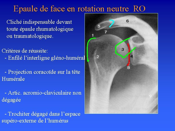 Epaule de face en rotation neutre RO Cliché indispensable devant toute épaule rhumatologique ou