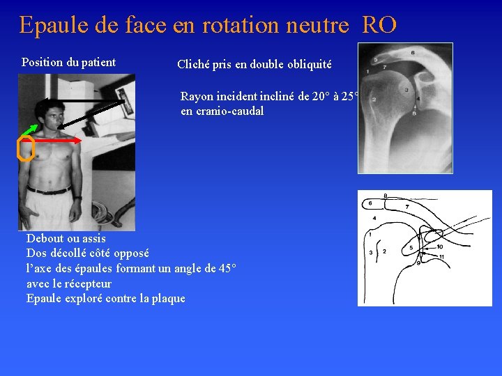 Epaule de face en rotation neutre RO Position du patient Cliché pris en double