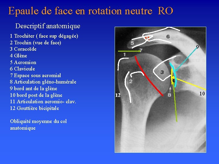 Epaule de face en rotation neutre RO Descriptif anatomique 1 Trochiter ( face sup