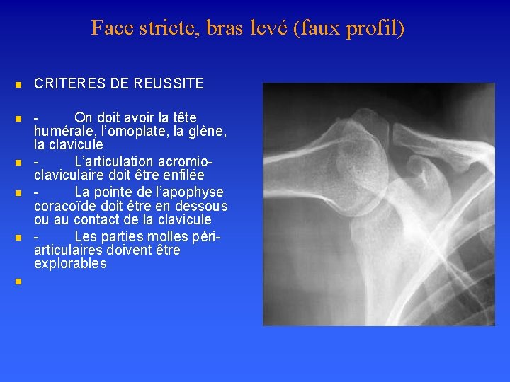 Face stricte, bras levé (faux profil) n CRITERES DE REUSSITE n - On doit