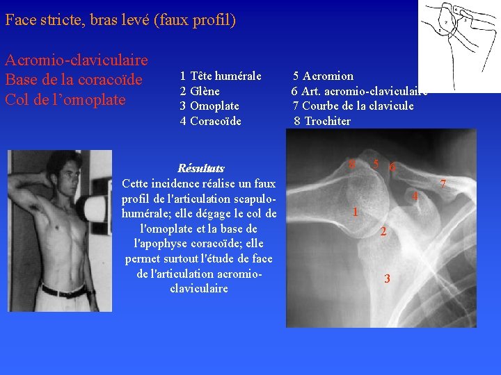 Face stricte, bras levé (faux profil) Acromio-claviculaire Base de la coracoïde Col de l’omoplate