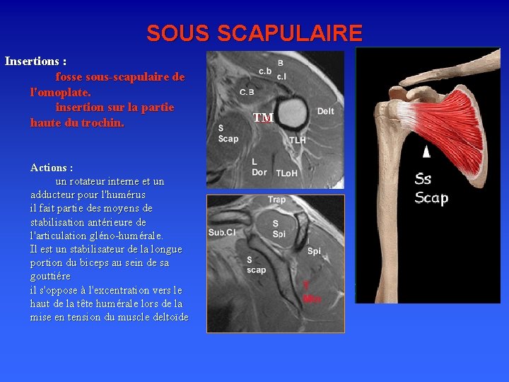 SOUS SCAPULAIRE Insertions : fosse sous-scapulaire de l'omoplate. insertion sur la partie haute du