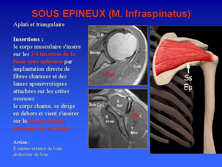 SOUS EPINEUX (M. Infraspinatus) Aplati et triangulaire Insertions : le corps musculaire s'insére sur