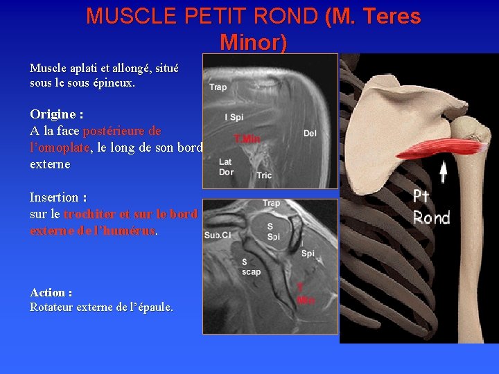 MUSCLE PETIT ROND (M. Teres Minor) Muscle aplati et allongé, situé sous le sous