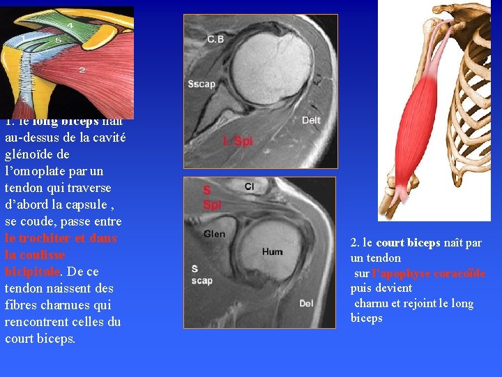 1. le long biceps naît au-dessus de la cavité glénoïde de l’omoplate par un