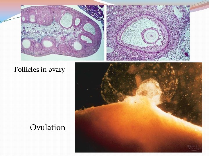 Follicles in ovary Ovulation 