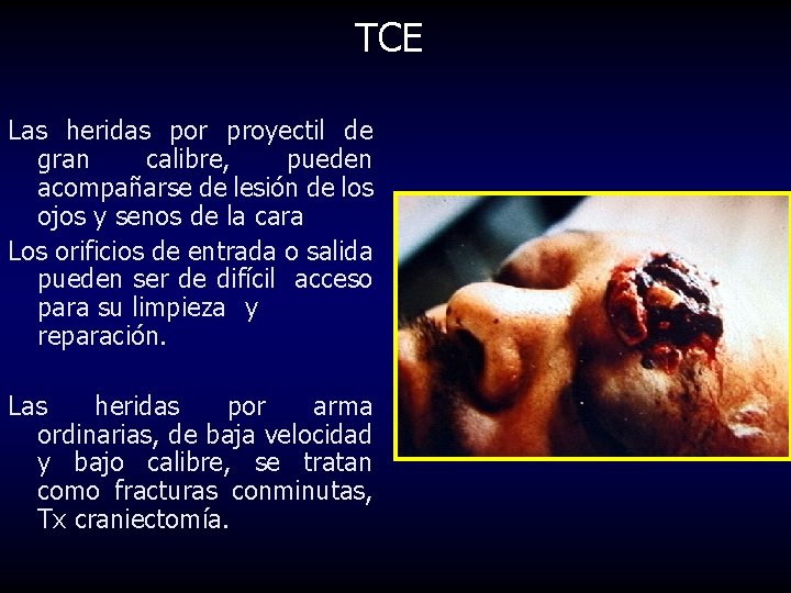 TCE Las heridas por proyectil de gran calibre, pueden acompañarse de lesión de los