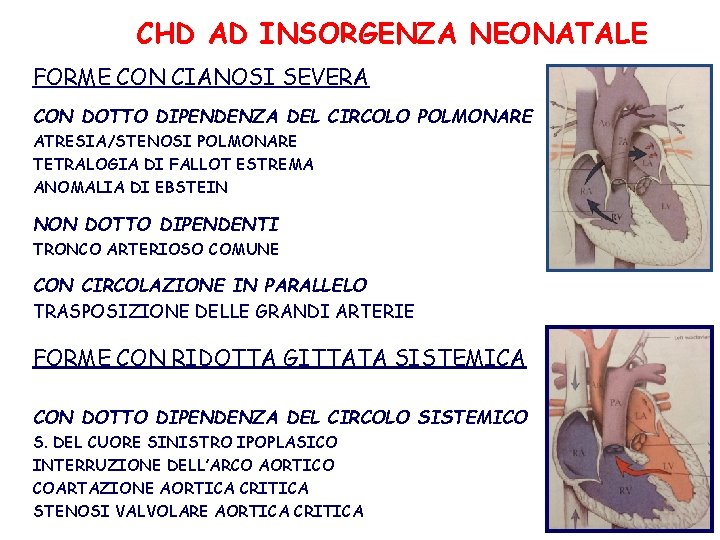 CHD AD INSORGENZA NEONATALE FORME CON CIANOSI SEVERA CON DOTTO DIPENDENZA DEL CIRCOLO POLMONARE