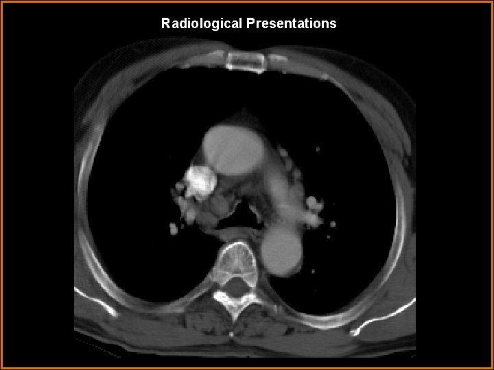 Radiological Presentations 