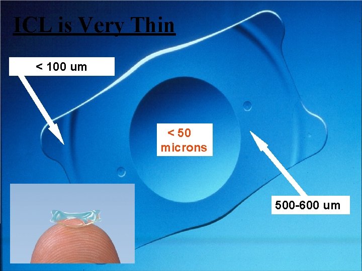 ICL is Very Thin < 100 um < 50 microns 500 -600 um 