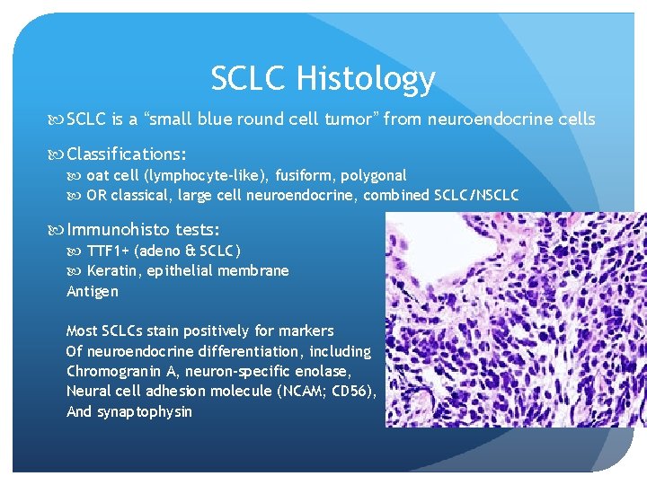SCLC Histology SCLC is a “small blue round cell tumor” from neuroendocrine cells Classifications: