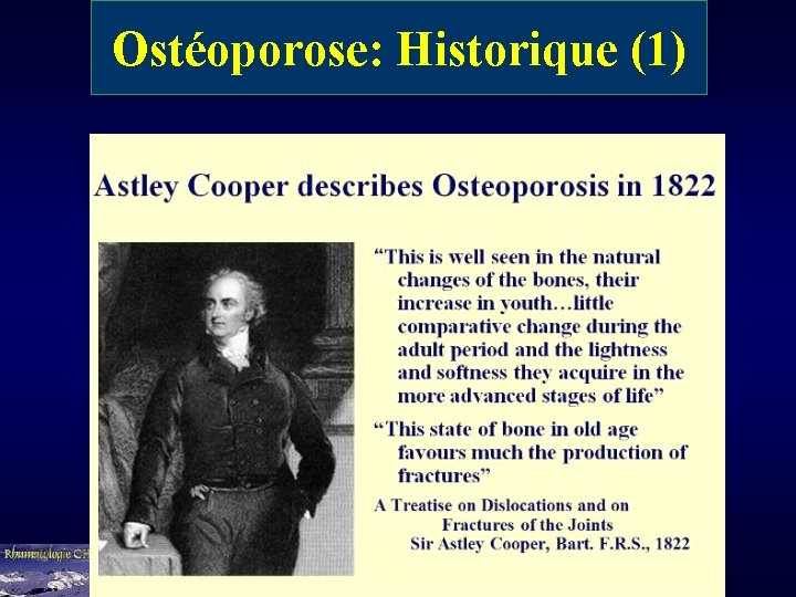 Ostéoporose: Historique (1) 