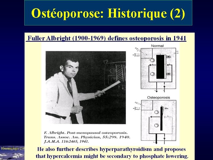 Ostéoporose: Historique (2) 