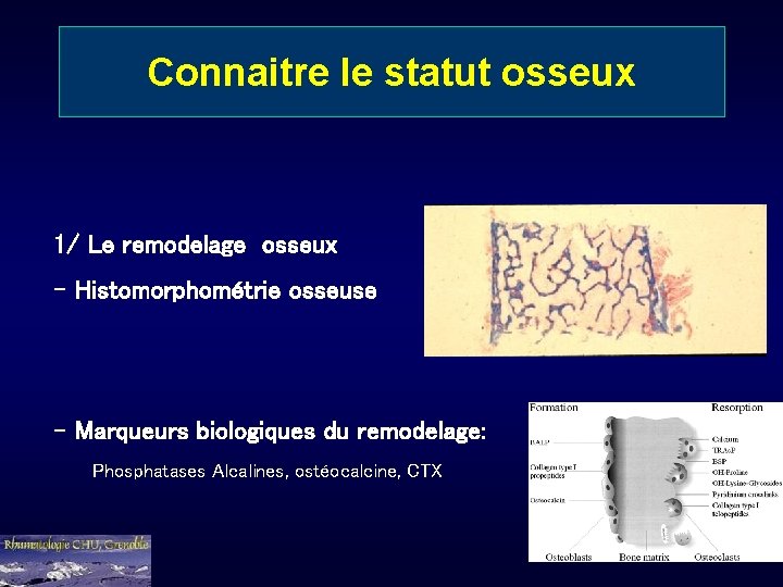 Connaitre le statut osseux 1/ Le remodelage osseux - Histomorphométrie osseuse - Marqueurs biologiques