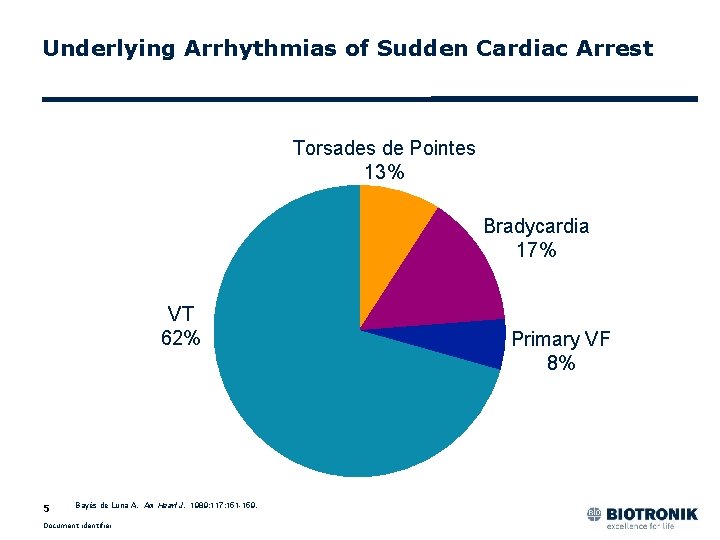 Underlying Arrhythmias of Sudden Cardiac Arrest Torsades de Pointes 13% Bradycardia 17% VT 62%