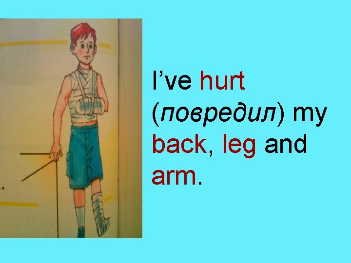 I’ve hurt (повредил) my back, leg and arm. 