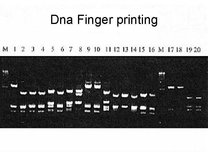 Dna Finger printing 