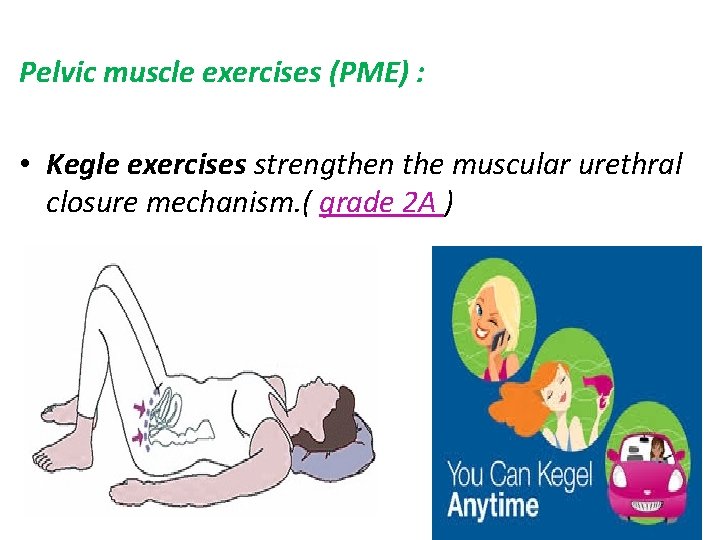 Pelvic muscle exercises (PME) : • Kegle exercises strengthen the muscular urethral closure mechanism.