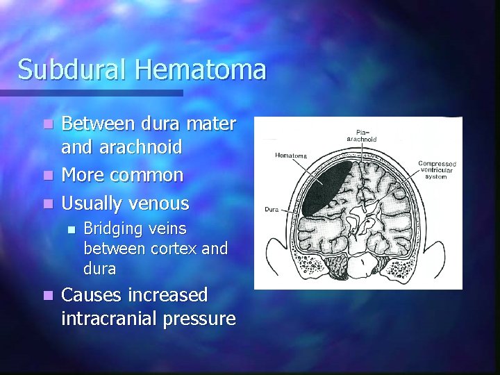 Subdural Hematoma Between dura mater and arachnoid n More common n Usually venous n