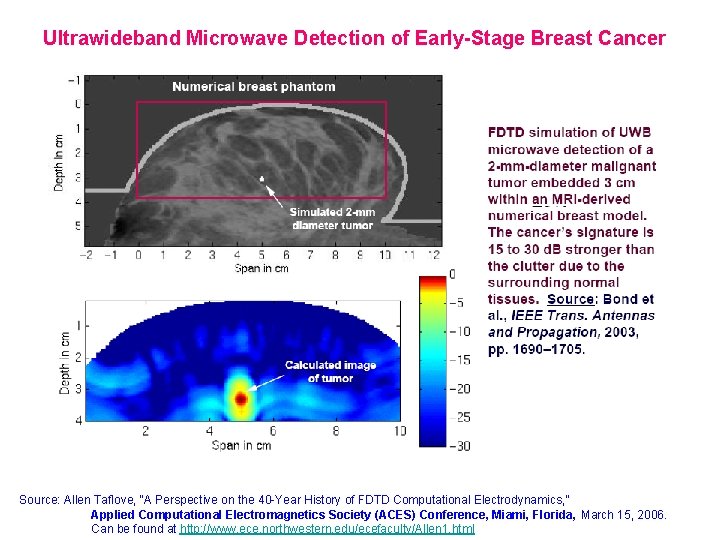 Ultrawideband Microwave Detection of Early-Stage Breast Cancer Source: Allen Taflove, “A Perspective on the