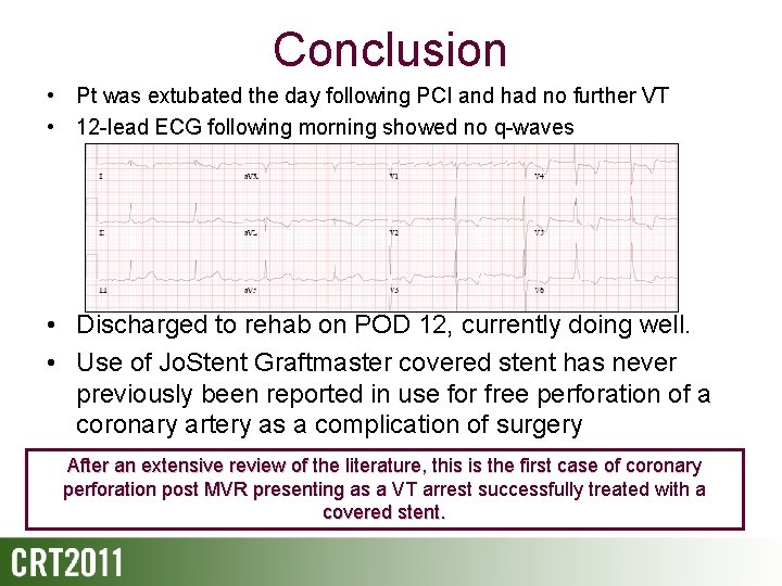 Conclusion • Pt was extubated the day following PCI and had no further VT