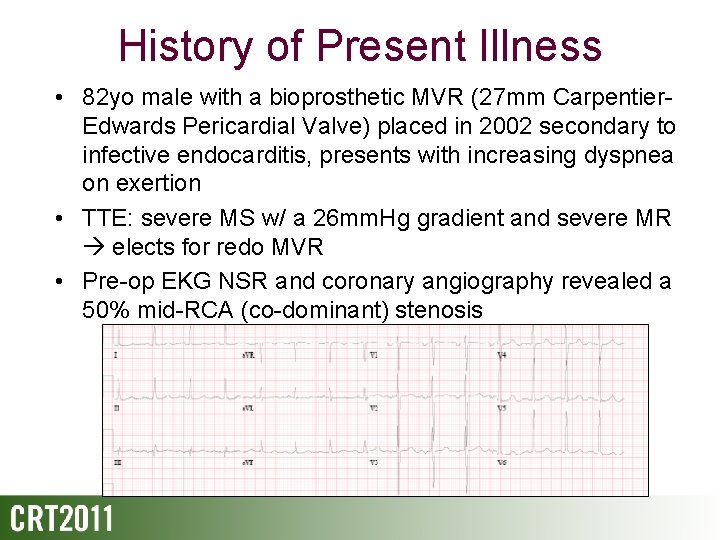 History of Present Illness • 82 yo male with a bioprosthetic MVR (27 mm