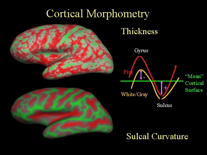 Cortical Morphometry Thickness Gyrus Pial - White/Gray + “Mean” Cortical Surface Sulcus Sulcal Curvature