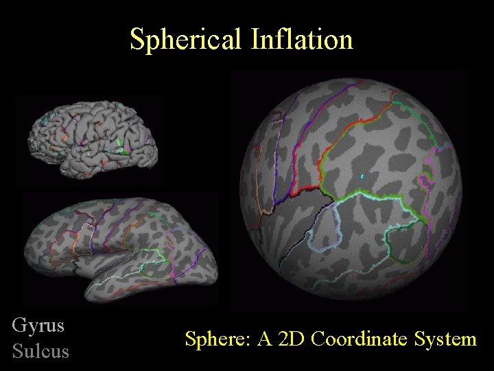 Spherical Inflation Gyrus Sulcus Sphere: A 2 D Coordinate System 
