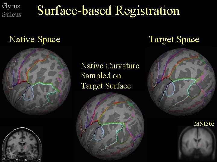 Gyrus Sulcus Surface-based Registration Native Space Target Space Native Curvature Sampled on Target Surface