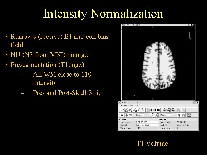 Intensity Normalization • Removes (receive) B 1 and coil bias field • NU (N