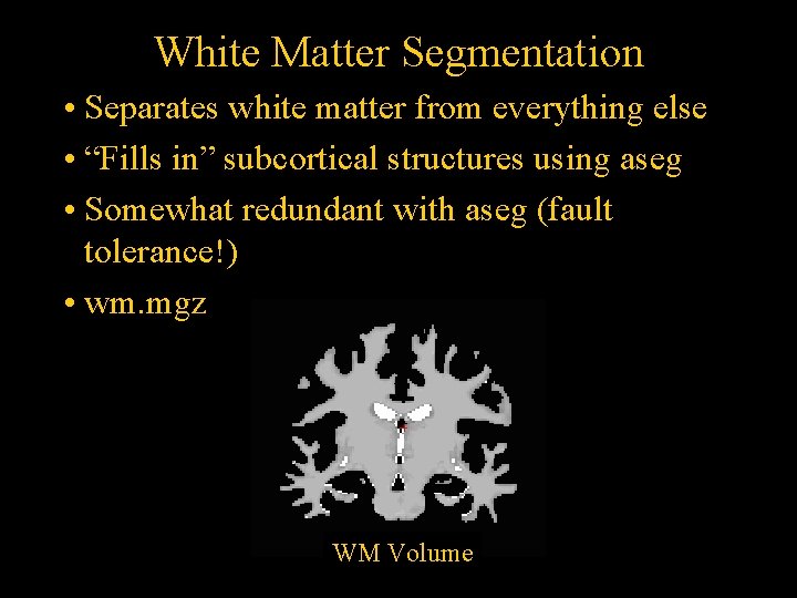 White Matter Segmentation • Separates white matter from everything else • “Fills in” subcortical