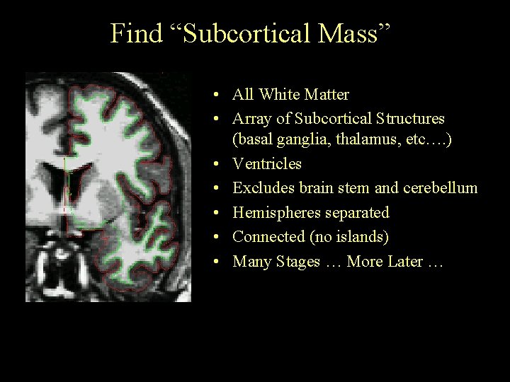 Find “Subcortical Mass” • All White Matter • Array of Subcortical Structures (basal ganglia,