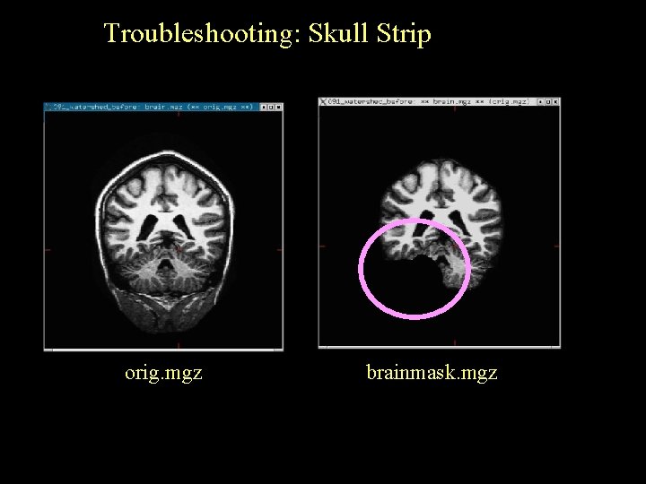 Troubleshooting: Skull Strip orig. mgz brainmask. mgz 