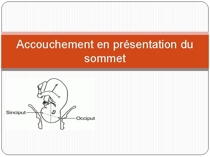 Accouchement en présentation du sommet 