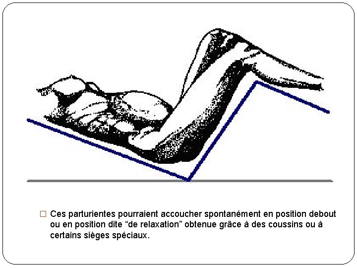 � Ces parturientes pourraient accoucher spontanément en position debout ou en position dite “de