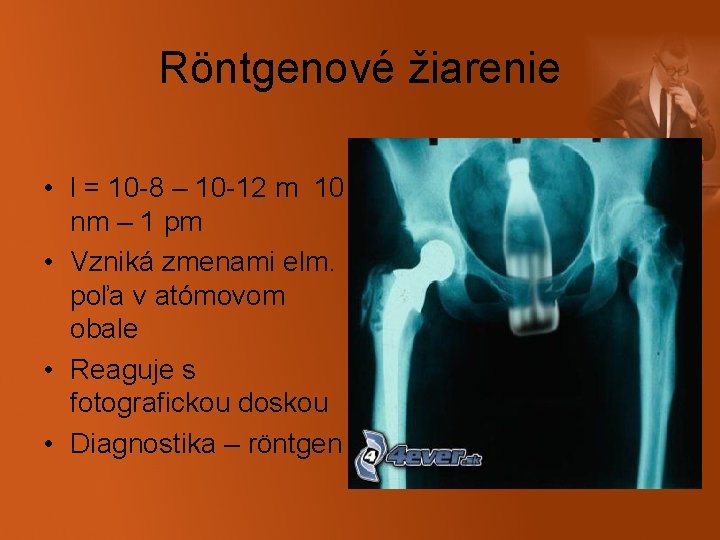 Röntgenové žiarenie • l = 10 -8 – 10 -12 m 10 nm –