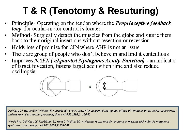 T & R (Tenotomy & Resuturing) • Principle- Operating on the tendon where the