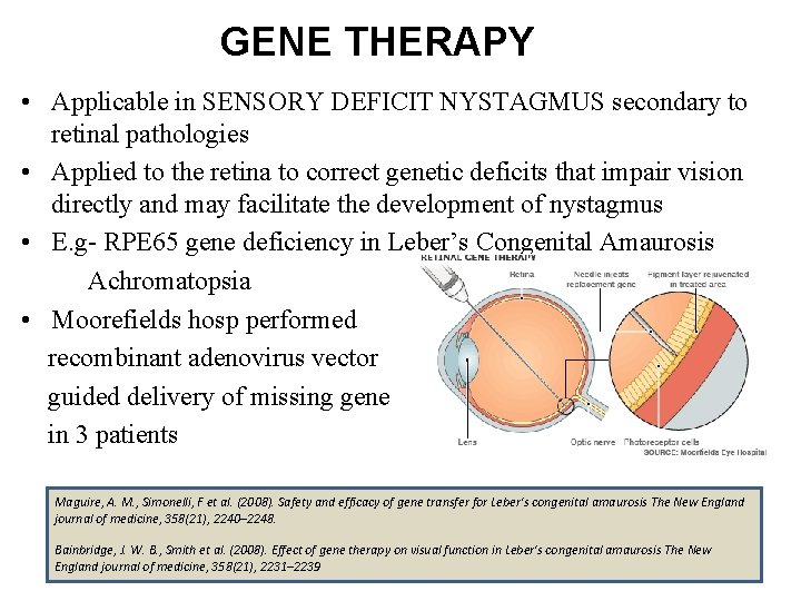 GENE THERAPY • Applicable in SENSORY DEFICIT NYSTAGMUS secondary to retinal pathologies • Applied