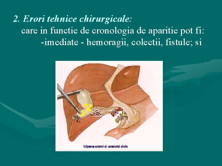 2. Erori tehnice chirurgicale: care in functie de cronologia de aparitie pot fi: -imediate