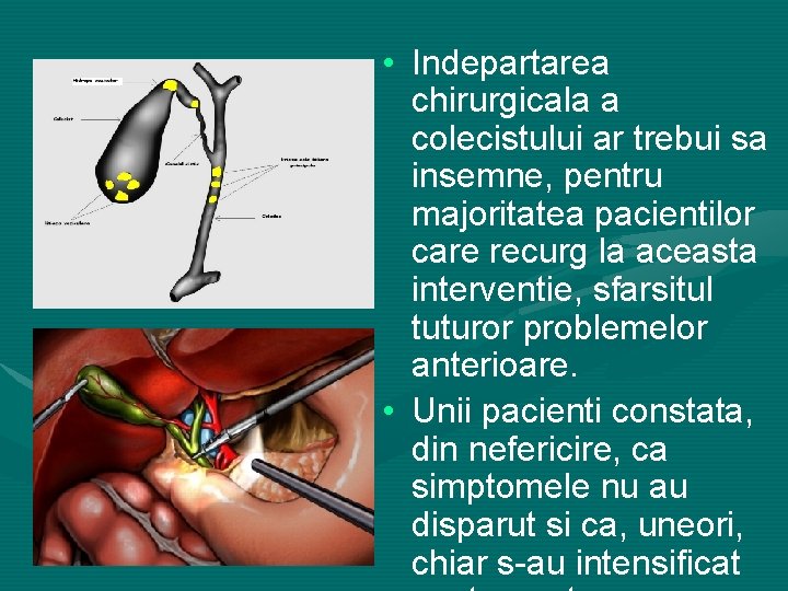  • Indepartarea chirurgicala a colecistului ar trebui sa insemne, pentru majoritatea pacientilor care