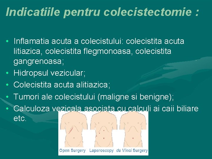 Indicatiile pentru colecistectomie : • Inflamatia acuta a colecistului: colecistita acuta litiazica, colecistita flegmonoasa,