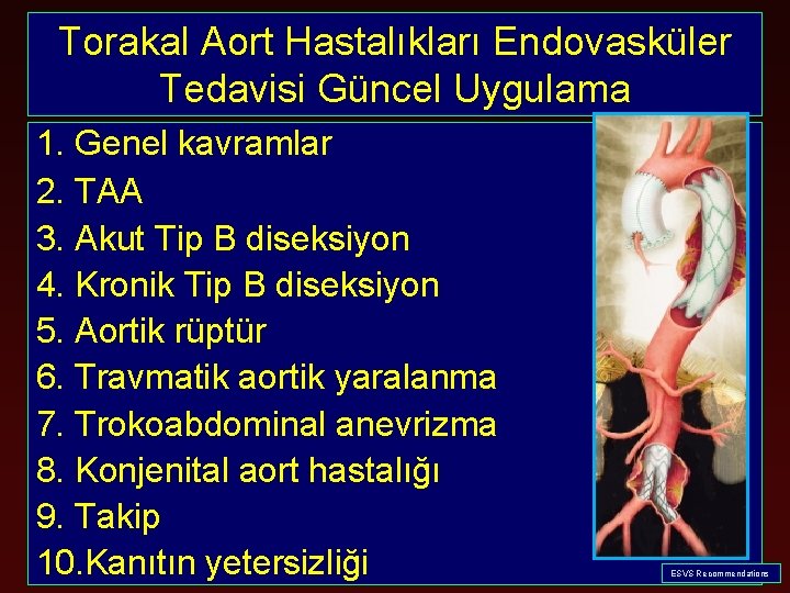 Torakal Aort Hastalıkları Endovasküler Tedavisi Güncel Uygulama 1. Genel kavramlar 2. TAA 3. Akut