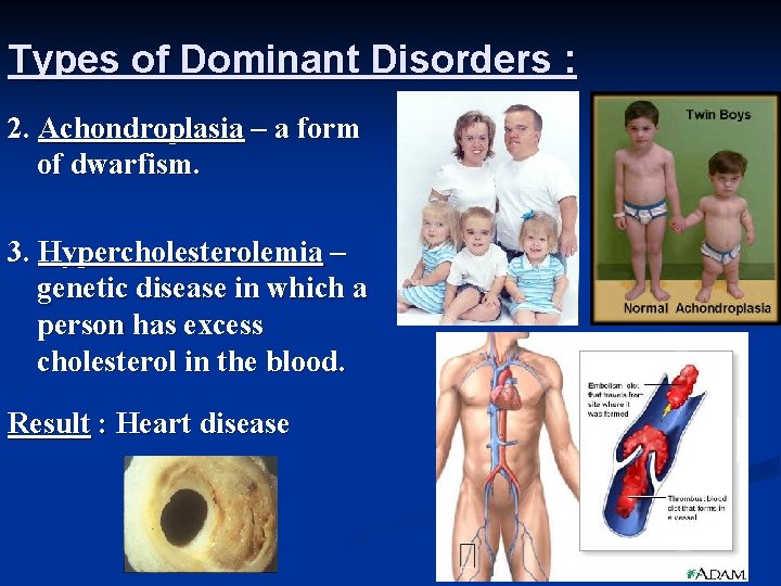 Types of Dominant Disorders : 2. Achondroplasia – a form of dwarfism. 3. Hypercholesterolemia